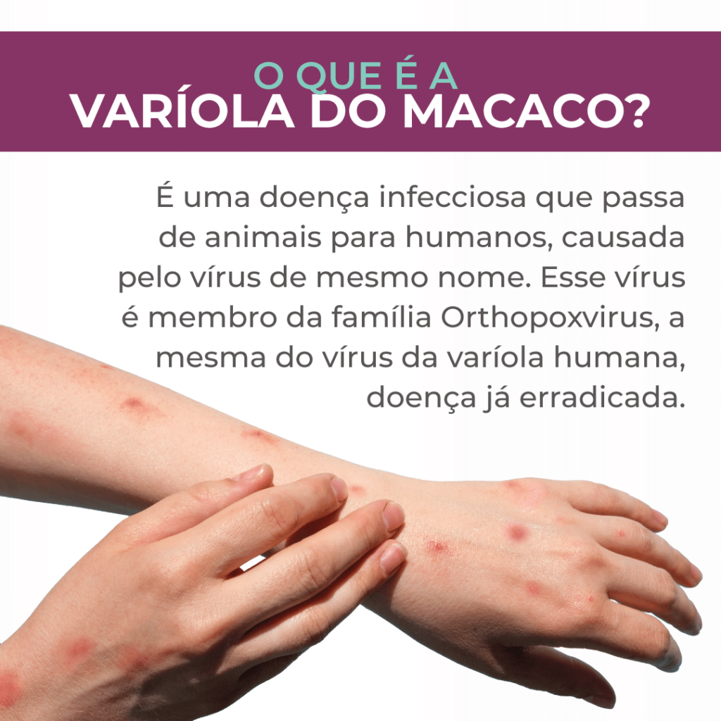 O que é a Varíola do Macaco Instituto Cisne Barueri